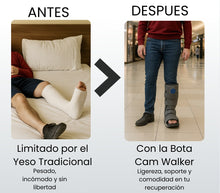 Bota Ortopédica Larga Cam Walker Alta Para Pie Oneder